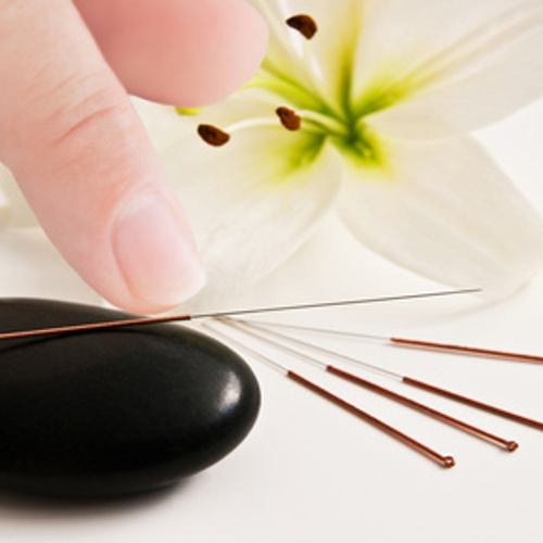 Acupuncture Traditionnelle Chinoise